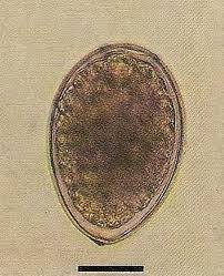 diphyllobothrium-latum